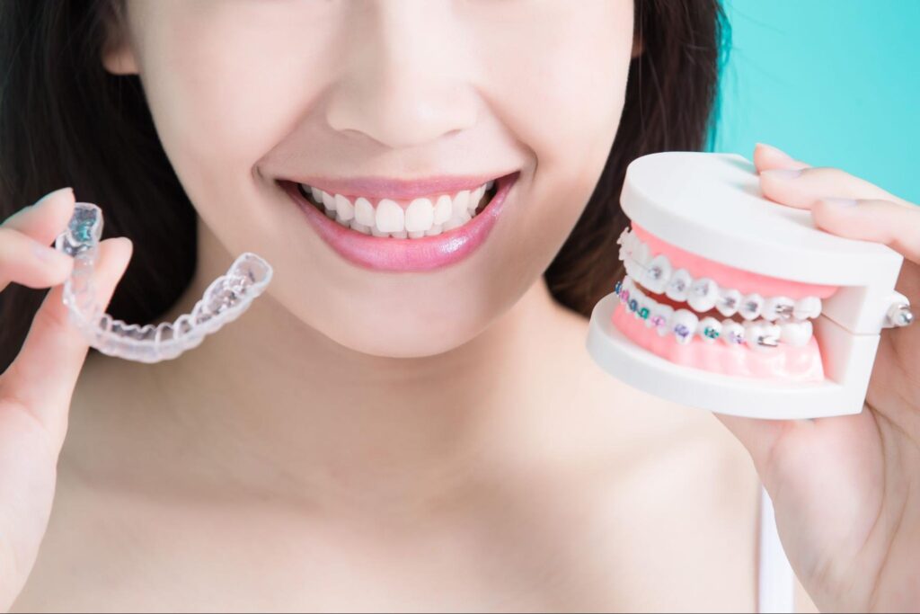 Choosing Between Metal and Clear Braces