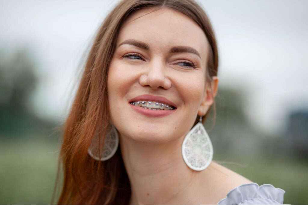 Choosing Between Metal and Clear Braces