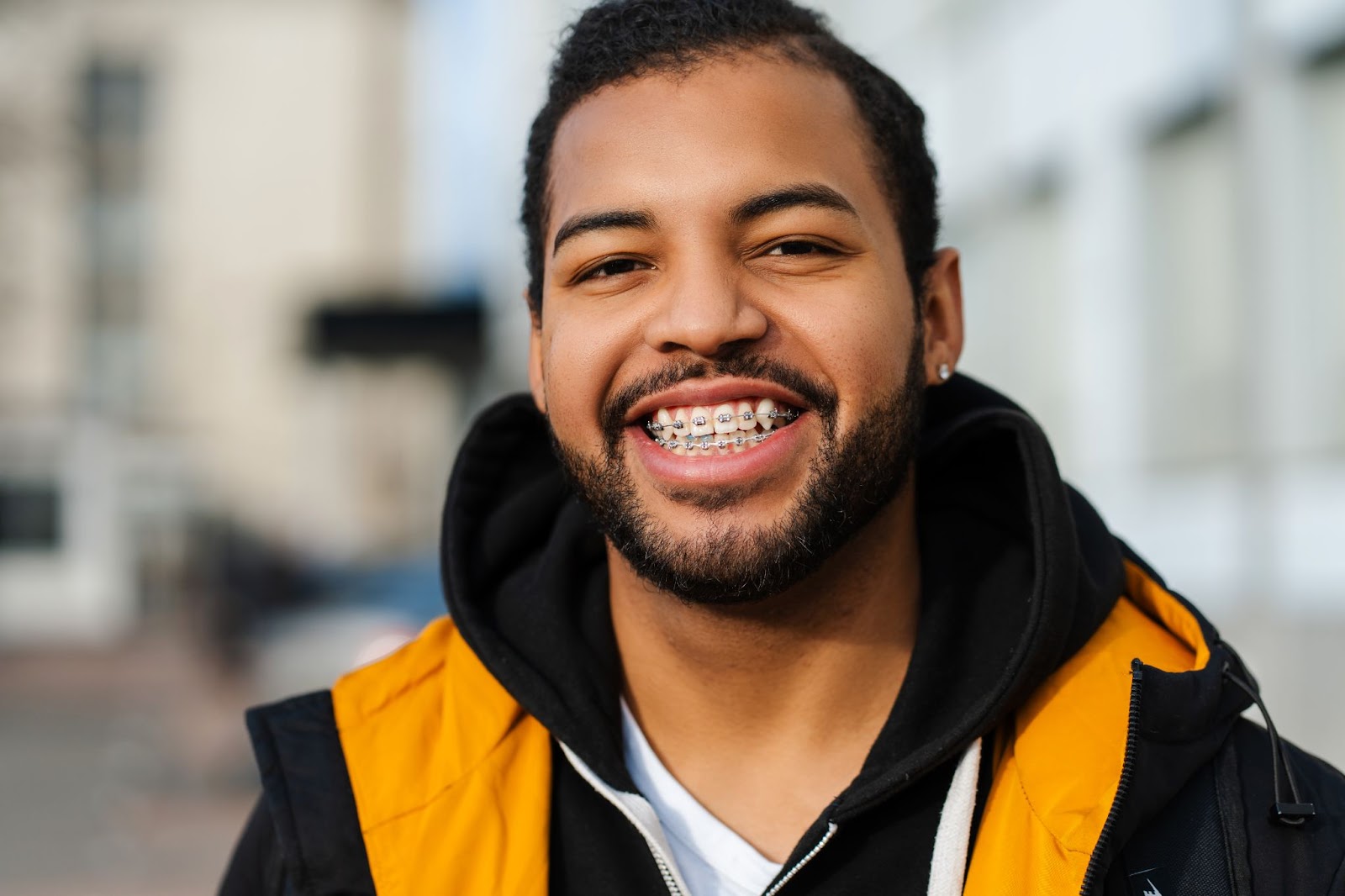 Why Adults in Rockford are Choosing Braces